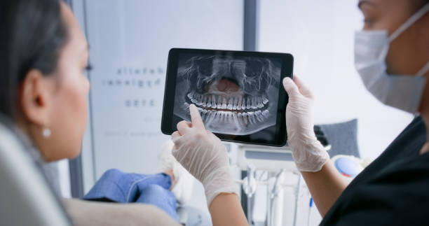 Licensed Tooth Extraction service in Burleson, TX - Smile Center Dentistry